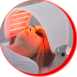 Red light therapy (RLT) is an emerging treatment that’s showing promise in treating wrinkles, redness, acne, scars and other signs of aging. Many researchers say more clinical trials are needed to confirm its effectiveness as a treatment. If you’re interested in red light therapy, ask your healthcare provider if this is an option for your skin issue.